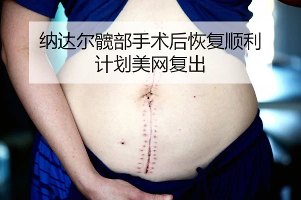 纳达尔髋部手术后恢复顺利 计划美网复出